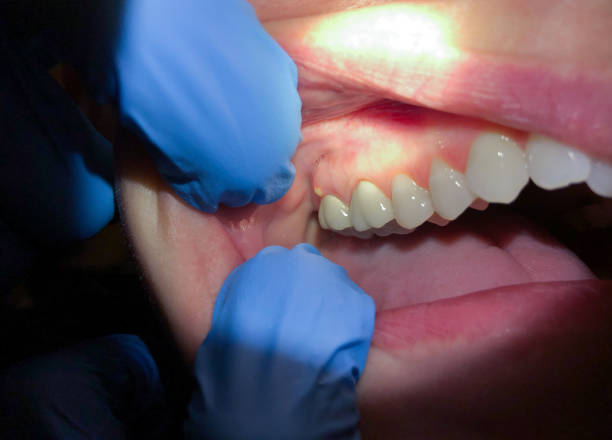 Best Pediatric Emergency Dentist in Jefferson, LA